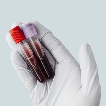 Is There A Genetic Test to Predict Early Menopause? - Cool-jams
